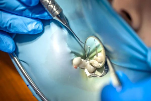 the-dentist-treats-the-child-s-tooth-using-a-rubbe-2026-03-24-01-27-38-utc